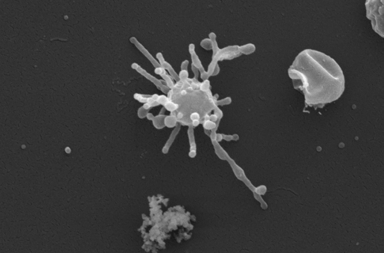 Предок всей жизни на Земле, возможно, обнаружен — это микроб со “скелетом”. Так выглядит адгардская бактерия, которая может быть предком всей жизни на Земле. Фото.