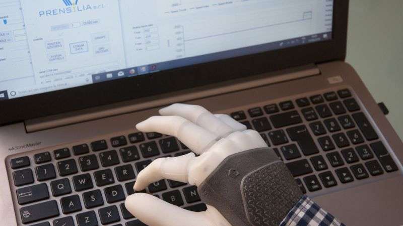 Настоящий киберпанк: бионический протез руки прирастили к кости человека и подключили к его нервной системе